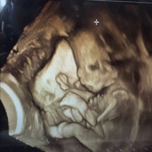 Meet your Posher, Sirine